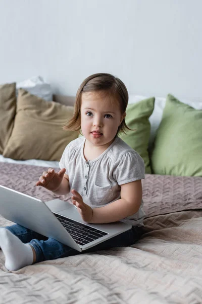 Enfant en bas âge avec le syndrome du duvet regardant la caméra près de l'ordinateur portable sur lit flou — Photo de stock