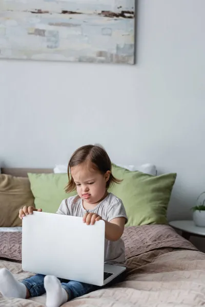 Child with down syndrome holding laptop on bed at home — Stock Photo