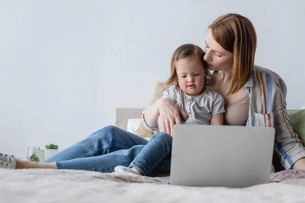 Мать целует малыша дочь с синдромом Дауна рядом с ноутбуком в спальне — стоковое фото
