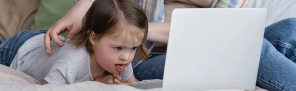 Kind mit Down-Syndrom schaut auf Laptop neben Elternteil im Bett, Banner — Stockfoto