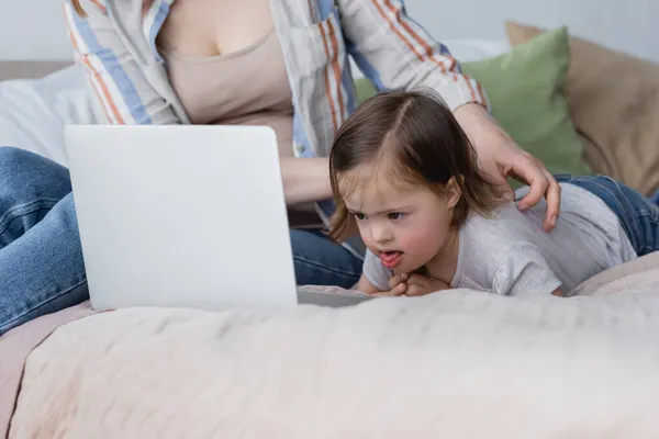 Mujer borrosa tocando niño con síndrome de Down cerca de la computadora portátil en la cama - foto de stock