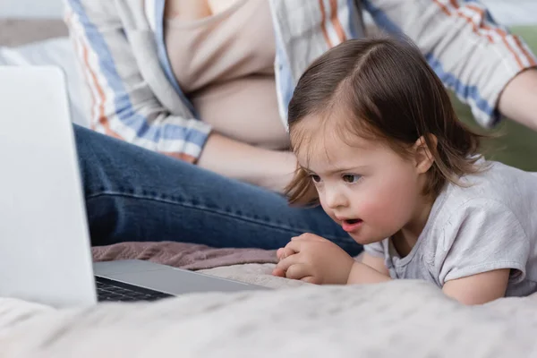 Kind mit Down-Syndrom blickt auf verschwommenen Laptop neben Mutter im Bett — Stockfoto