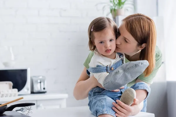 Mutter küsst Kind mit Down-Syndrom und Backhandschuh in Küche — Stockfoto