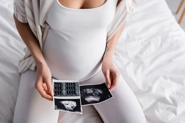 Partial view of pregnant woman holding ultrasound pictures — Stock Photo