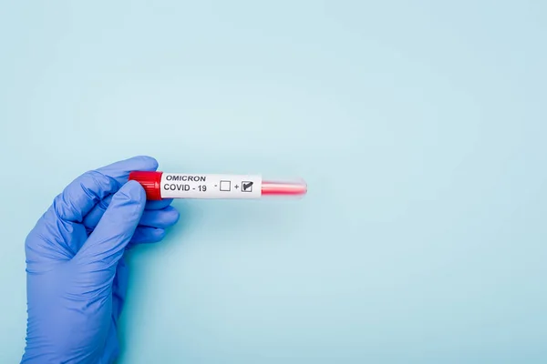 Partial view of doctor holding positive covid-19 omicron variant test on blue background — Foto stock