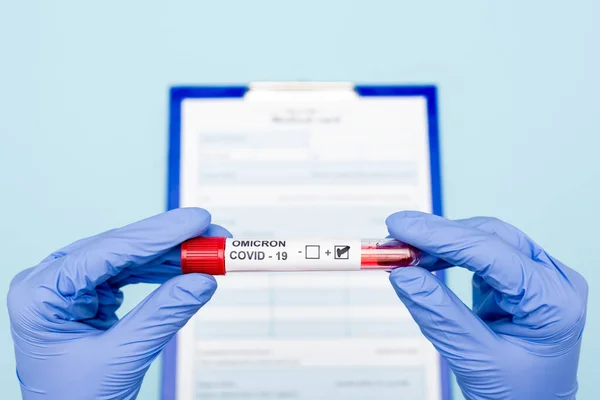 Cropped view of doctor in latex gloves holding test tube with covid-19 positive result near blurred clipboard on blue — Fotografia de Stock