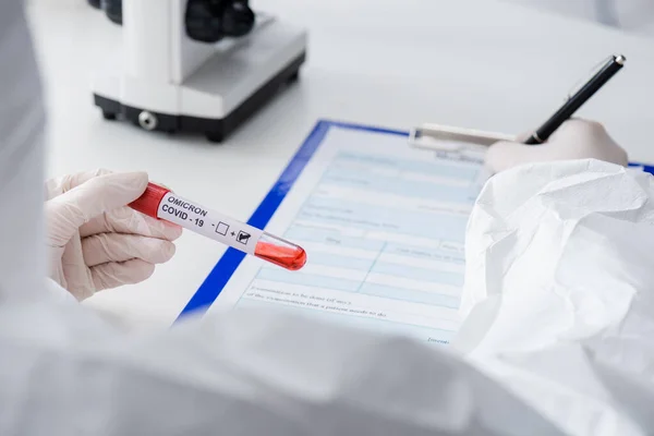 Cropped view of blurred doctor with positive covid-19 omicron variant test writing on clipboard in lab — Fotografia de Stock