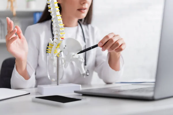 Vue recadrée du médecin pointant vers le modèle de la colonne vertébrale près d'un ordinateur portable flou à l'hôpital — Photo de stock