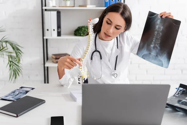 Médico segurando radiografia e modelo espinhal perto de dispositivos na clínica — Fotografia de Stock