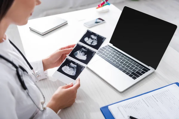 Vista ritagliata del medico che tiene la scansione ad ultrasuoni del bambino vicino agli appunti e al laptop — Foto stock