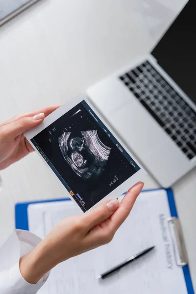 Top view of doctor holding ultrasound scan of baby near blurred laptop and clipboard in clinic — Stock Photo