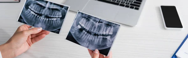Vista recortada del médico sosteniendo escáneres de dientes cerca de aparatos borrosos en la clínica, pancarta - foto de stock