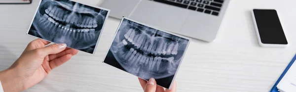 Cropped view of doctor holding scans of teeth near blurred gadgets in clinic, banner — Stock Photo