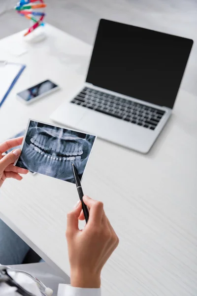 Vista recortada del médico sosteniendo la pluma y escaneando los dientes cerca de dispositivos borrosos en la mesa - foto de stock