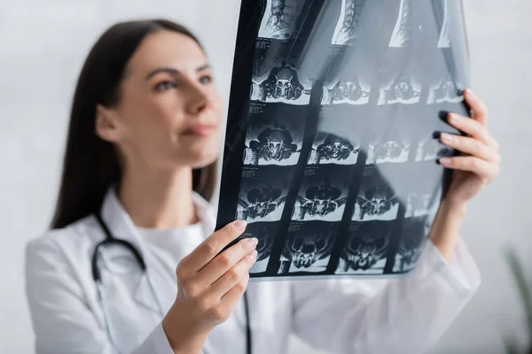 Mri scan in hands of blurred doctor in clinic — Stock Photo
