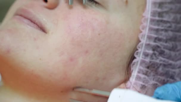 Schoonheidsspecialiste die elektrische impulsen gebruikt voor gezichtsbehandelingen. Vrouw in spa salon. — Stockvideo