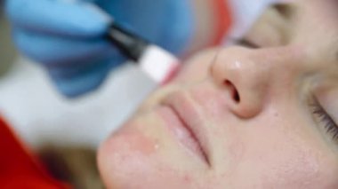 Güzellik kliniği konsepti. Profesyonel yüz ameliyatı olan genç bir kadın..