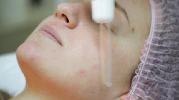 Cosmetologia. Primo piano di giovane faccia femminile durante la terapia microcorrente. — Video Stock