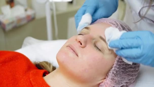 Косметолог протирає крем з анестетичними бавовняними подушечками від обличчя дівчини — стокове відео