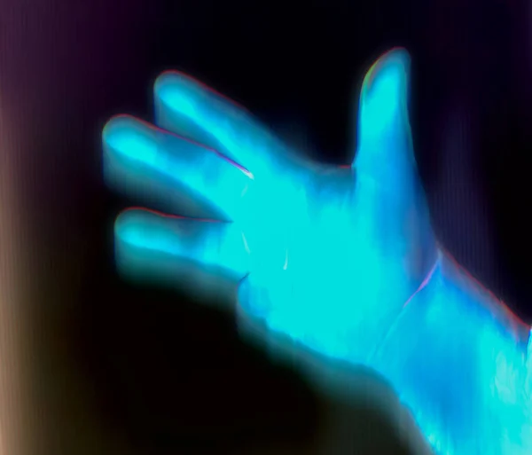 Illustratie Van Een Stralende Menselijke Hand Een Röntgenfoto — Stockfoto