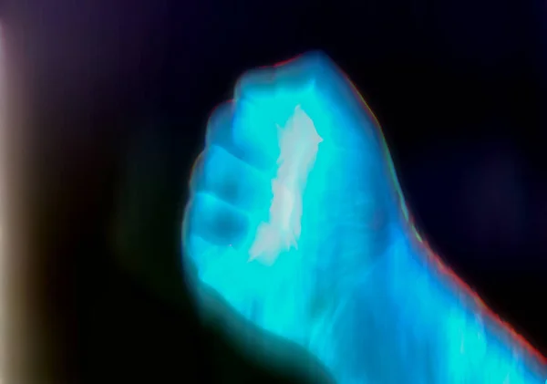 Иллюстрация Светящейся Мужской Руки Рентгеновском Обзоре — стоковое фото