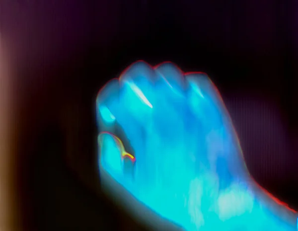 Ray Görüntüsünde Parlayan Bir Insan Elinin Boyutlu Görüntüsü — Stok fotoğraf