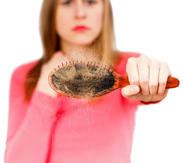 Ohälsosamma håravfall — Stockfoto