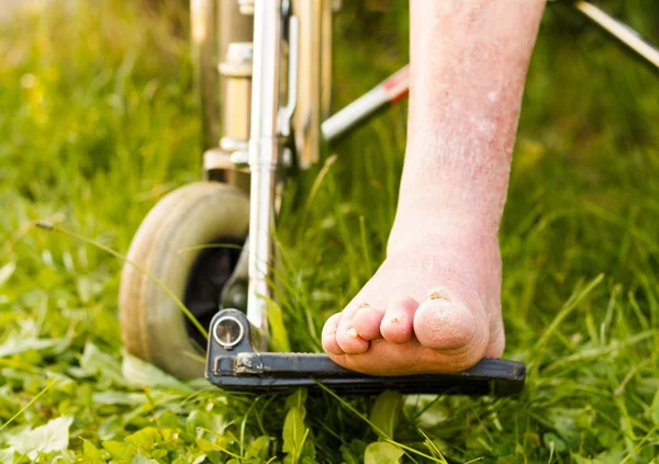 Артросклеротическая старая нога — стоковое фото