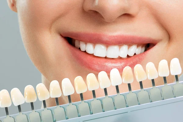 Lächelnde junge Frau. Kosmetologische Zahnaufhellung in einer Zahnklinik. Auswahl des Tonus des Implantatzahns — Stockfoto