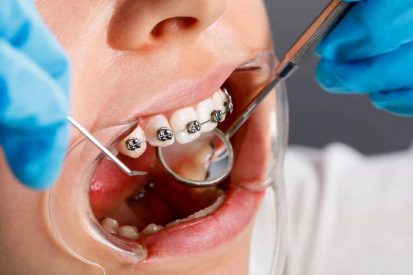 A young woman with metal braces is being examined by an orthodontist. Correction of the bite of teeth in the dental clinic. Concept of healthy teeth. — Stockfoto