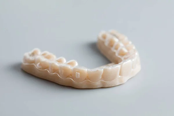 Individual silicone tooth tray for whitening. Teeth whitening concept. — Stock Photo, Image