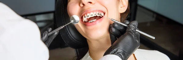 En ung kvinna med metallställning undersöks av en ortodontist. Korrigering av bett av tänder på tandvårdskliniken. Begreppet friska tänder. banderoll — Stockfoto