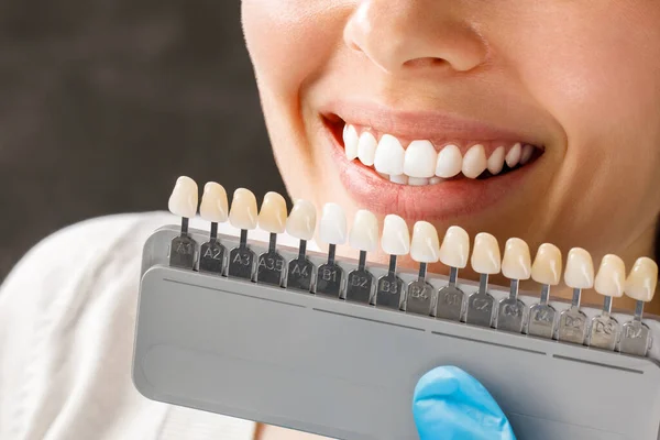 Smiling young woman. Cosmetological teeth whitening in a dental clinic. selection of the tone of the implant tooth — Stock Photo, Image