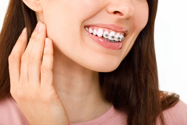 Ortodontisk behandling. Tandvårdskoncept. Vacker kvinna Friska leende närbild. Närbild Keramik och metall fästen på tänder. Vackra kvinnliga leenden med hängslen — Stockfoto