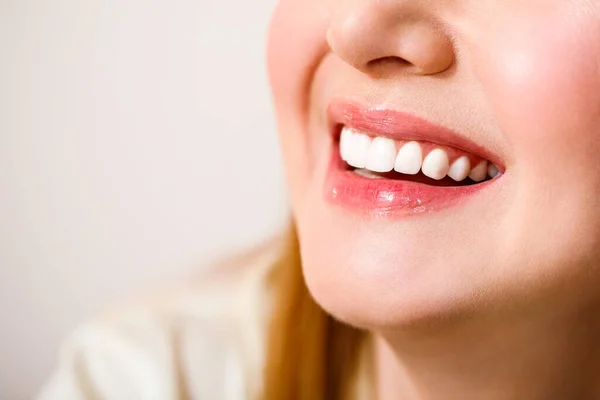 Belo sorriso feminino após o procedimento de clareamento dos dentes. Cuidados dentários. Conceito de Odontologia. Em um fundo azul. — Fotografia de Stock