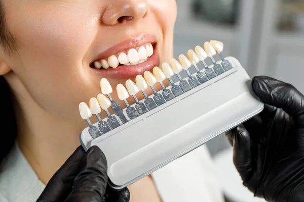 Leende ung kvinna. Kosmetologisk tandblekning på en tandvårdsklinik. val av tonläge på implantattanden — Stockfoto