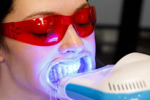 Een jonge vrouw krijgt een tanden bleken procedure in een tandheelkundige kliniek Stockafbeelding