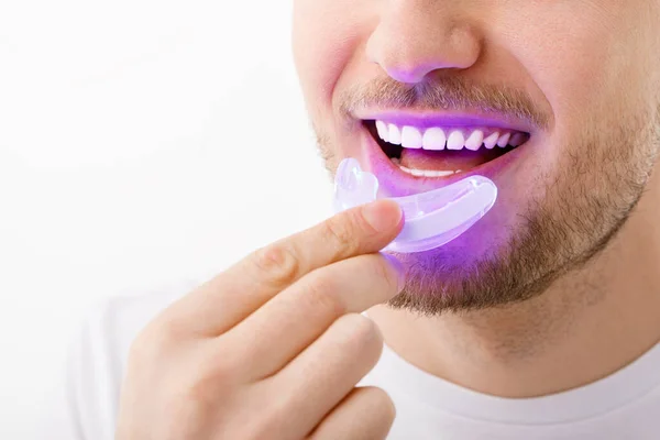 Un hombre sostiene en su mano una lámpara ultravioleta para blanquear los dientes en casa. Una sonrisa blanca como la nieve después del blanqueamiento. Imagen de archivo