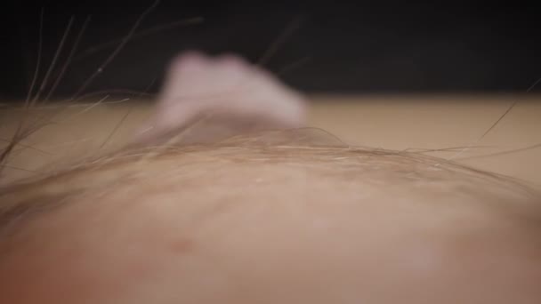 Hautoberfläche mit langen Haaren, die am Bein des Menschen wachsen — Stockvideo