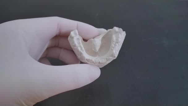 Ortodontista pega um elenco da mandíbula inferior feita de gesso — Vídeo de Stock