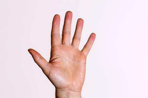 Hands Person — Stock Photo, Image
