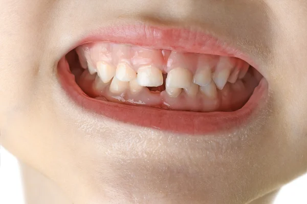 Makro çocuk diş — Stok fotoğraf