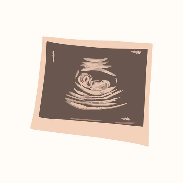 Ultrasound of a child in the womb, printed on paper. Vector illustration.