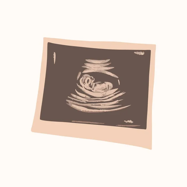 Ultrasound Child Womb Printed Paper Vector Illustration Vecteurs De Stock Libres De Droits