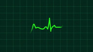 Kalp atışı kardiyogramı ya da EKG Hareketli Kalp Hattı ya da Yeşil Kalp Geçmişi
