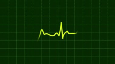 Kalp atışı kardiyogramı ya da EKG Hareketli Kalp Hattı ya da Yeşil Kalp Geçmişi