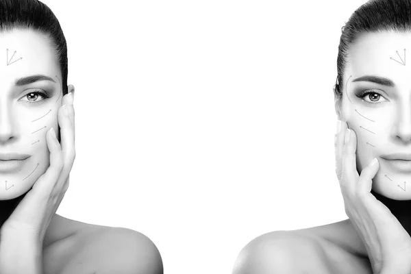 Cirugía Concepto Antienvejecimiento Dos Retratos Media Cara Con Flechas Elevadoras —  Fotos de Stock