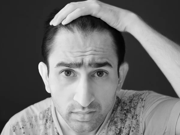 Homem preocupado com queda de cabelo — Fotografia de Stock