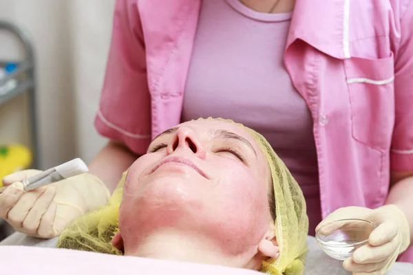 Professionele schoonheidsspecialiste gaat een kalmerend masker met een borstel aan te brengen op een patiënt rode huid na een chemische peeling. — Stockfoto