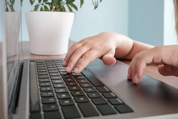 Kinderhände Tippen Auf Der Laptop Tastatur Auf Dem Tisch Großaufnahme — Stockfoto